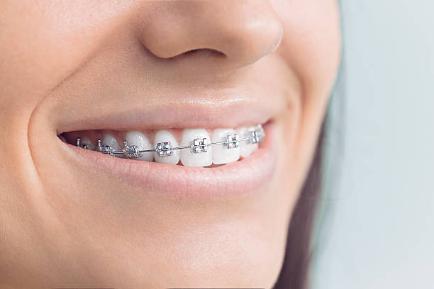 Best Laser Dentistry  in St Martins, MO
